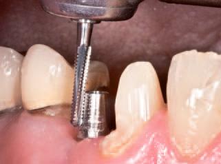 Использование бора H856G-016-FG